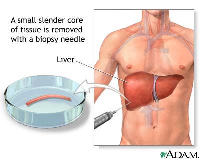 Term long accutane damage liver