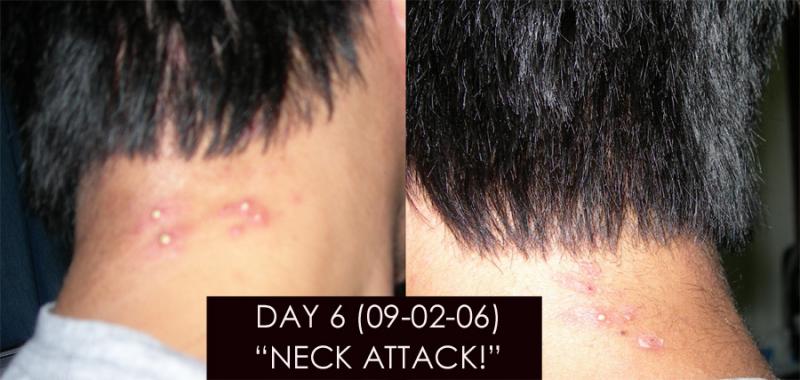 Day 6 "Neck Attack!"