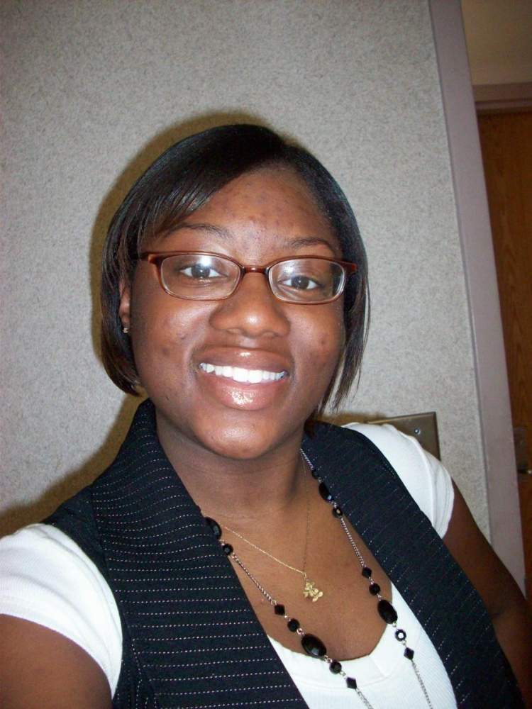 Before ACCUTANE!!