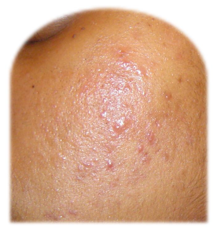 what kind of skin is this ???