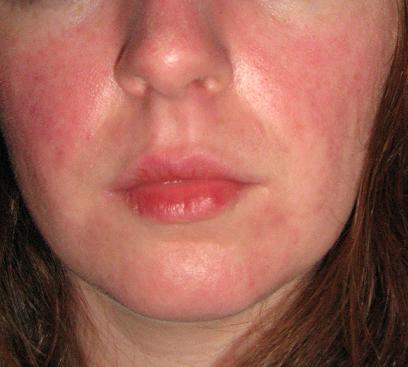 Month 4