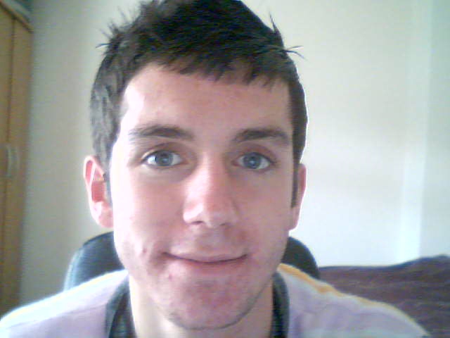 Accutane Progress Pictures