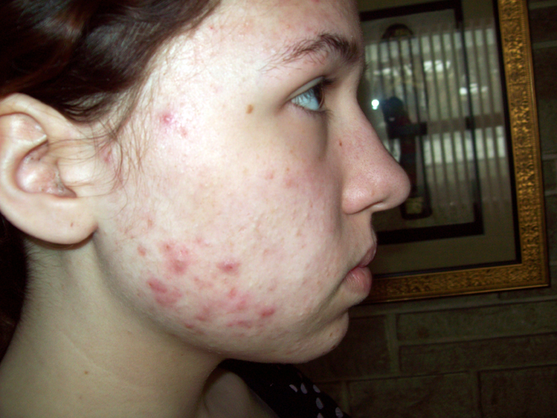 BEFORE&general pictures of myself