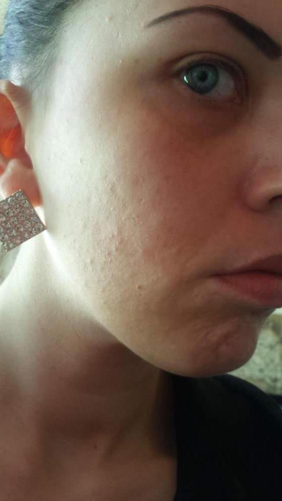 My skin