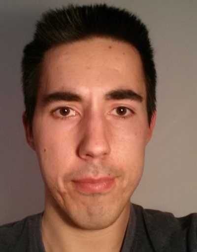 Aftermath; 9 years of treatments