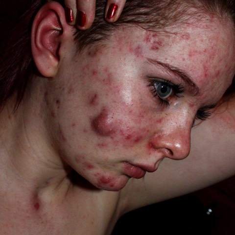 tenten xxx free sibiling incest porn