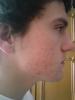 post-116866-1269716771_thumb.jpg
