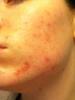 post-120146-1299554710_thumb.jpg