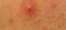 post-116262-1270754596_thumb.jpg
