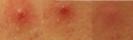 post-116262-1270943211_thumb.jpg