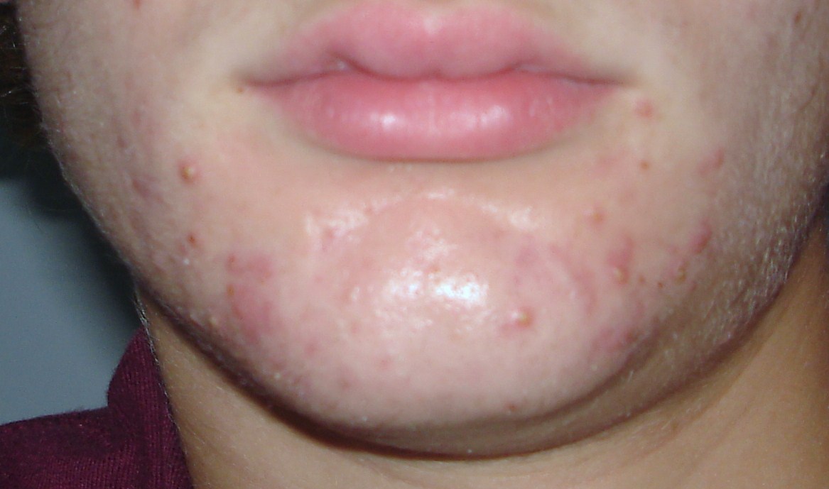 ziana log Personal logs