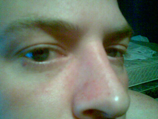 nose goes rule nose goes rule