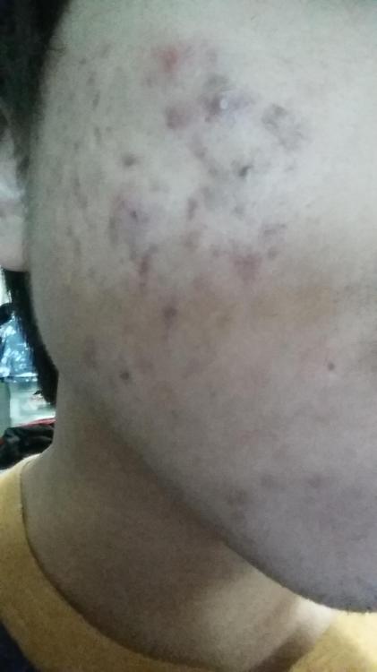 20151130_164123.jpg
