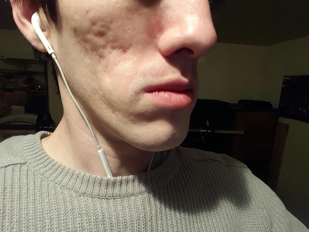 20151223_041735.jpg
