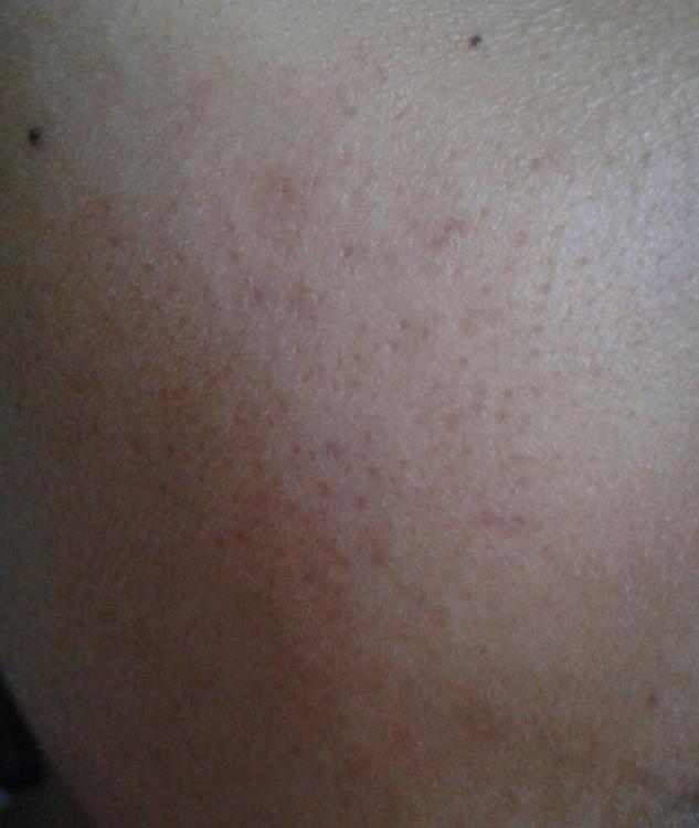 20160131_174146-1.thumb.jpg.9a03d4f04b98