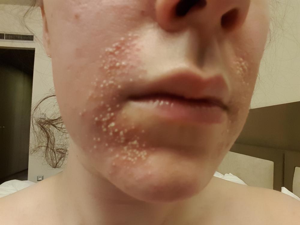 20160312_090505.jpg