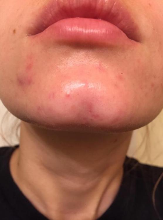 nose (2).jpg