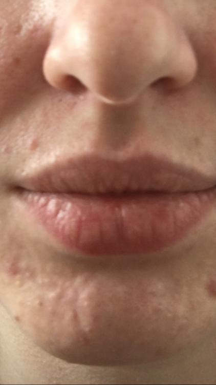 IMG_0029.PNG