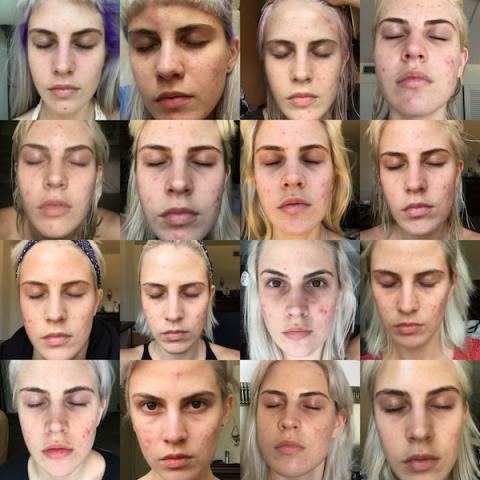 Xenical orlistat roche trova prezzo