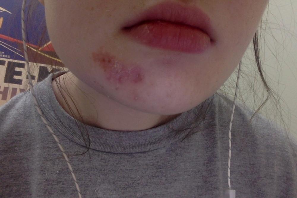 bad chin.jpg