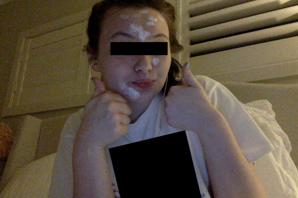 my night treatment.jpg