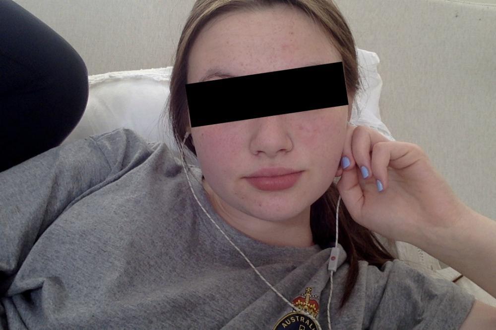 my skin today.jpg