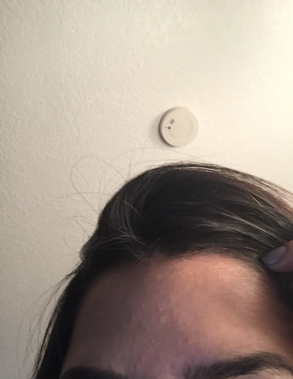 Forehead Bumps Please Help General Acne Discussion