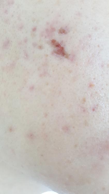 20170121_121044.jpg