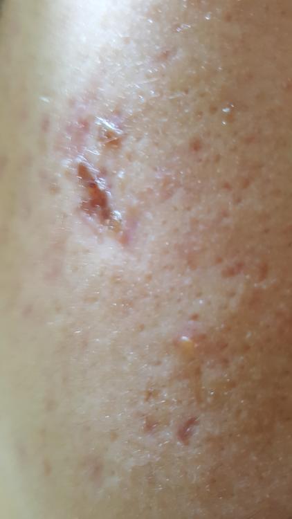 20170121_121328.jpg
