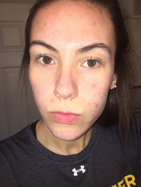 Before.jpg