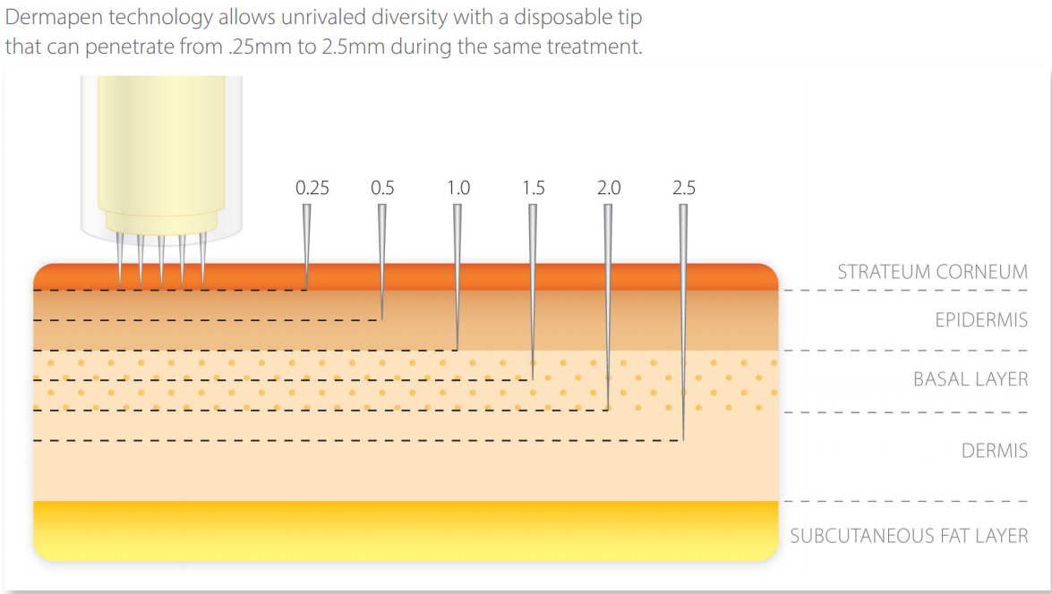 The Complexity of Micropen/DermaPen Treatments - Scar treatments - Acne.org