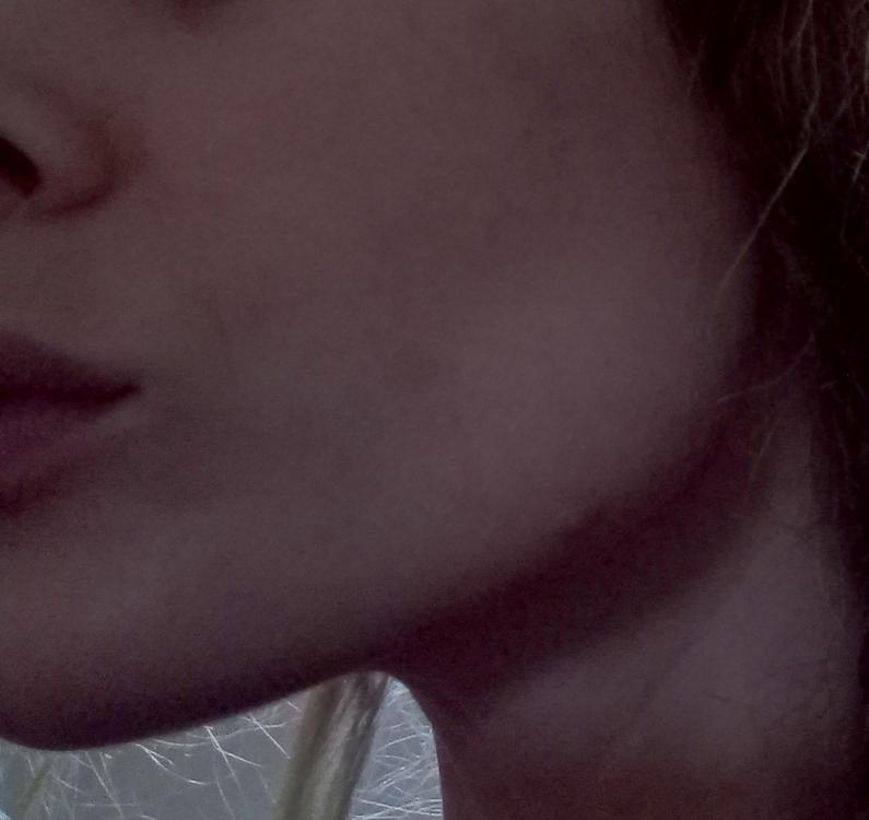 skin.jpg