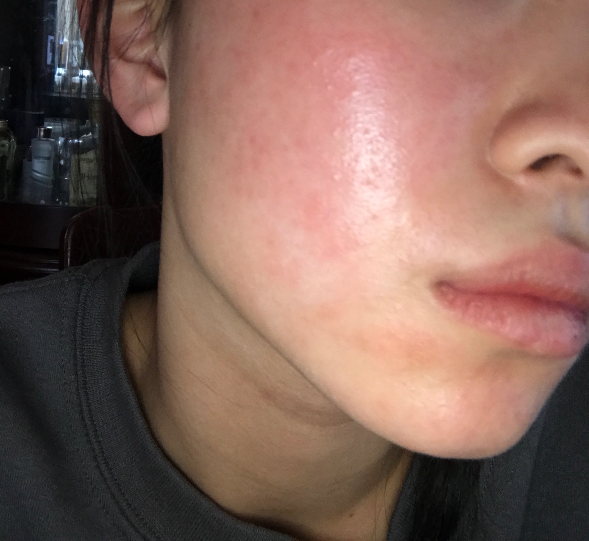 Why Is My Face Itchy With Little Bumps Allergy Trigger
