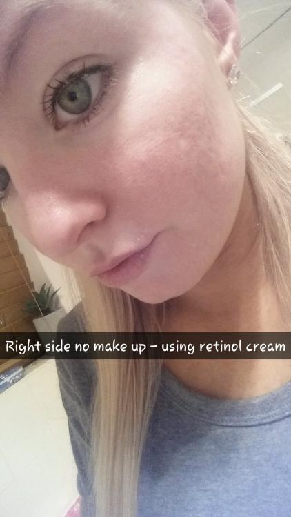 Snapchat-537917229.jpg