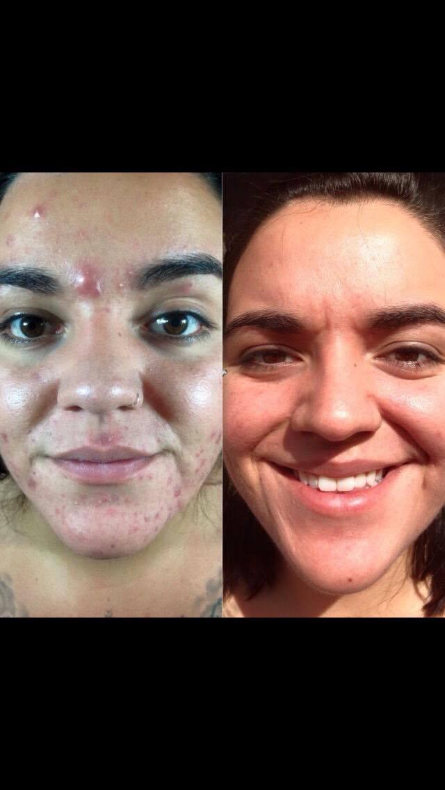 April