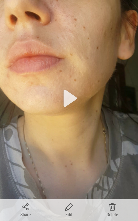 20170727_102724.png