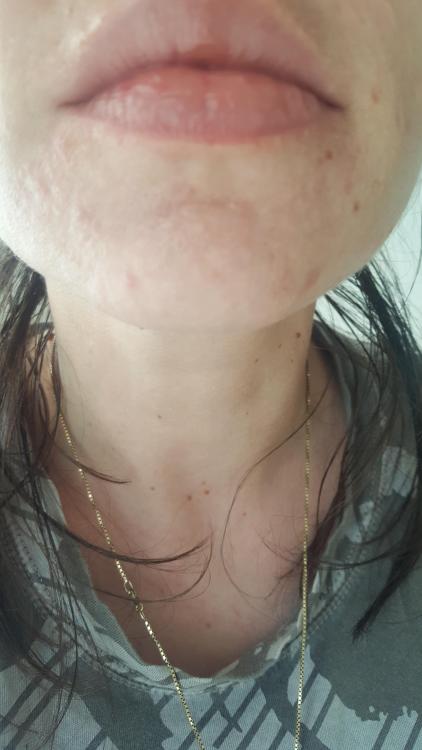 20170728_164940.jpg