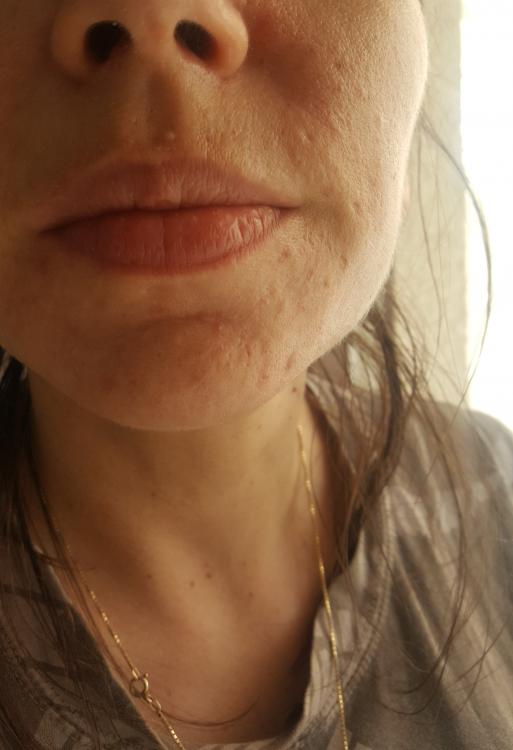 20170728_165646.jpg