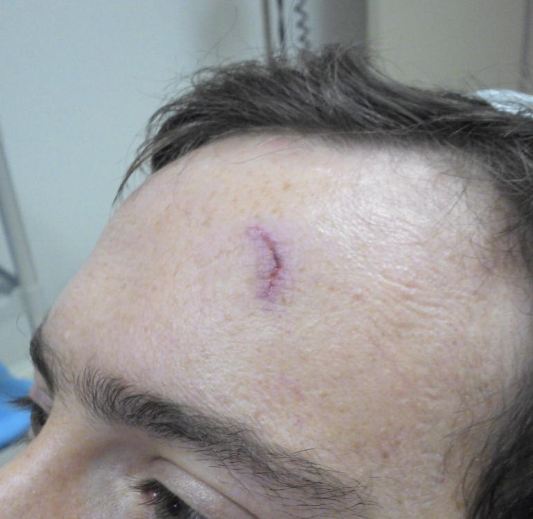 day after the incident.jpg