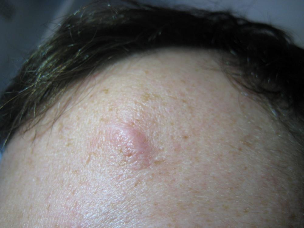 6 months after incident (2).JPG