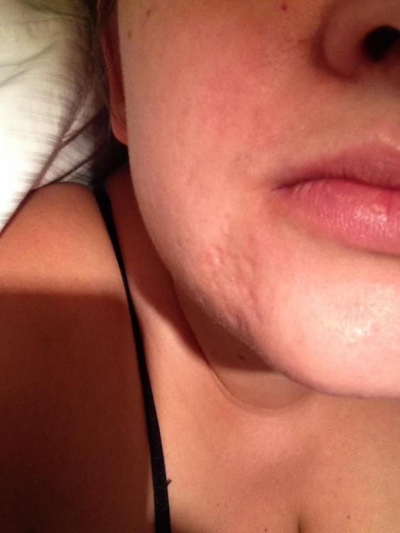 scars1 (2).JPG