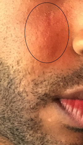 SkinPic1.png