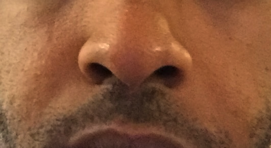 Skinpic2.png