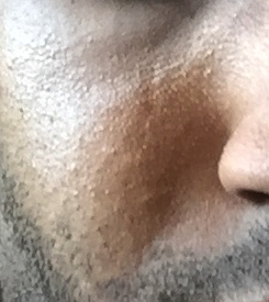 Skinpic3.png