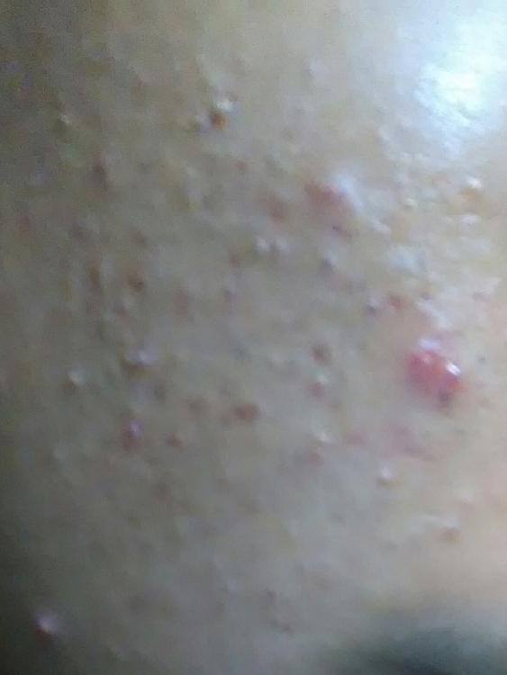 P_20171206_180145_BF_1.jpg