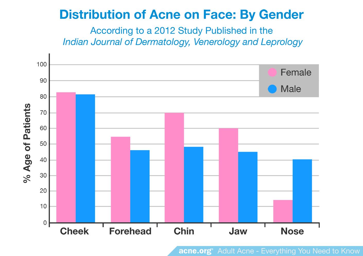 Adult Acne Everything You Need To Know