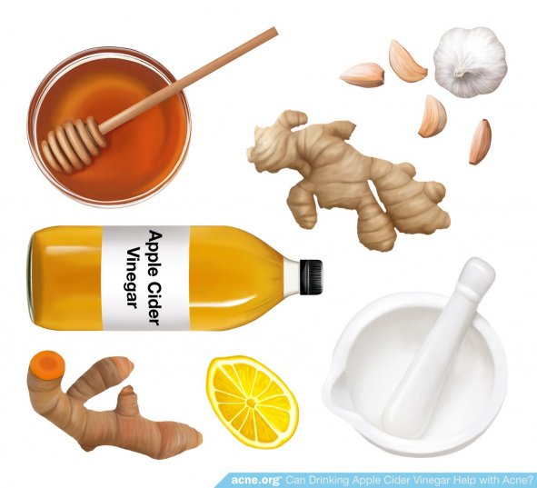 Apple Cider Vinegar in Medicine