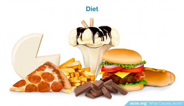 Diet