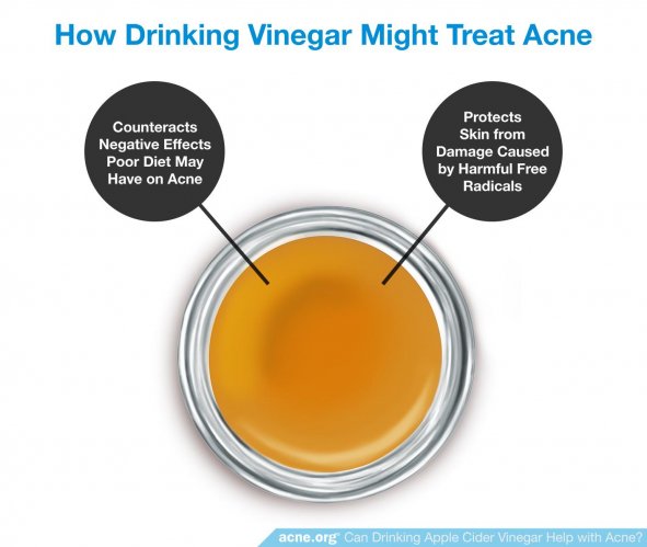 How Drinking Vinegar Might Treat Acne