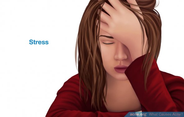 Stress
